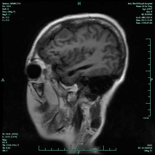 神经系统病变是什么病的症状? 神经系统病变是什么病的症状?