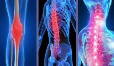 强直专家:上班族腰背痛,警惕可能是强直 强直专家:上班族腰背痛,警惕可能是强直