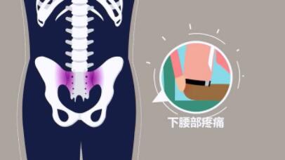 专家提醒:上班族防着点强直性脊柱炎 专家提醒:上班族防着点强直性脊柱炎