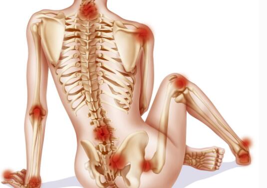 强直性脊柱炎的健康教育 强直性脊柱炎的健康教育