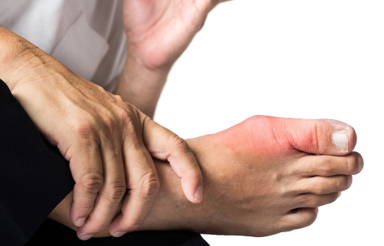 什么是痛风，为何脚趾先疼痛