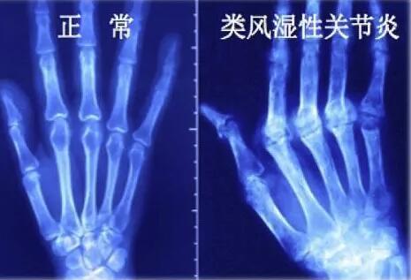 ǿֱʪҽԺʪԹؽμô