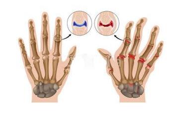 ǿֱʪҽԺʪԹؽμô